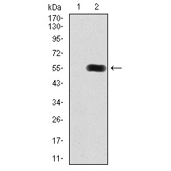 Histone Deacetylase 9 (HDAC9) Antibody