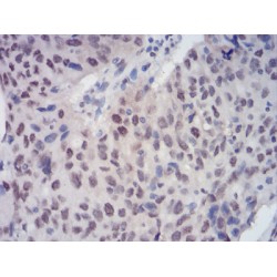 Chromobox Protein Homolog 3 (CBX3) Antibody
