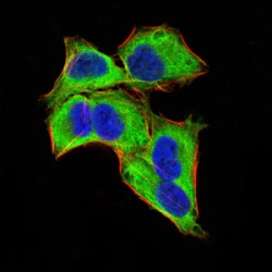 Zinc Finger Protein GLI1 (GLI1) Antibody