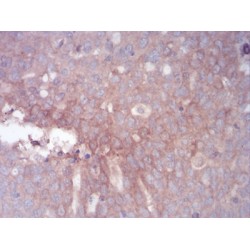 Zinc Finger Protein GLI1 (GLI1) Antibody