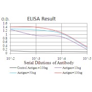 Fig. 1. Black line: Control Antigen (100 ng); Purple line: Antigen(10ng); Blue line: Antigen (50 ng); Red line: Antigen (100 ng)