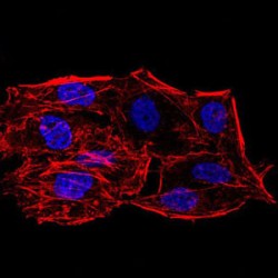 NAD-Dependent Protein Deacetylase Sirtuin-6 (SIRT6) Antibody
