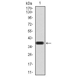 Peroxisome Proliferator Activated Receptor Alpha (PPARA) Antibody