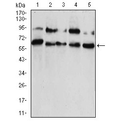 Chromobox Homolog 2 (CBX2) Antibody