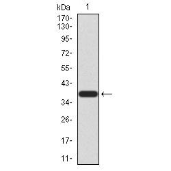 Chromobox Homolog 2 (CBX2) Antibody