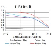 Fig. 1. Black line: Control Antigen (100 ng); Purple line: Antigen(10ng); Blue line: Antigen (50 ng); Red line: Antigen (100 ng)