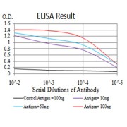 Fig. 1. Black line: Control Antigen (100 ng); Purple line: Antigen(10ng); Blue line: Antigen (50 ng); Red line: Antigen (100 ng)