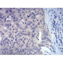 Forkhead Box Protein P3 (FOXP3) Antibody