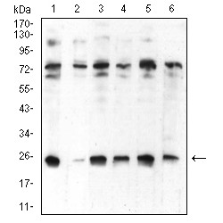 Chromobox Homolog 5 (CBX5) Antibody