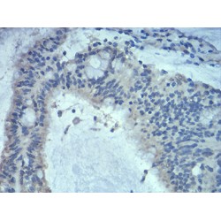 Ras-Related Protein Rab-5A (Rab5a) Antibody