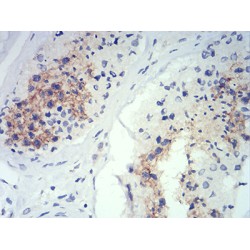 Beclin 1-Associated Autophagy-Related Key Regulator (ATG14L) Antibody