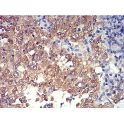 PR Domain Zinc Finger Protein 4 (PRDM4) Antibody