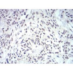 Interleukin-28A (IL28A) Antibody