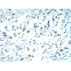 Importin Subunit Alpha-2 (KPNA2) Antibody