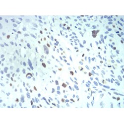 Importin Subunit Alpha-2 (KPNA2) Antibody