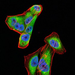 Complement Factor H-Related Protein 5 (CFHR5) Antibody