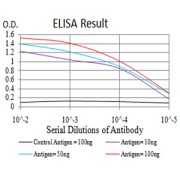 Fig. 1. Figure 1:Black line: Control Antigen (100 ng)Purple line: Antigen (10ng); Blue line: Antigen (50 ng); Red line:Antigen (100 ng)