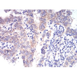 Methylmalonate-Semialdehyde Dehydrogenase [acylating], Mitochondrial (ALDH6A1) Antibody