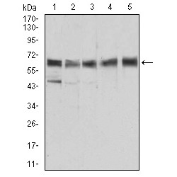 Methylmalonate-Semialdehyde Dehydrogenase [acylating], Mitochondrial (ALDH6A1) Antibody