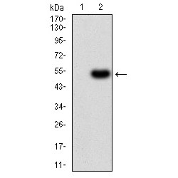 Methylmalonate-Semialdehyde Dehydrogenase [acylating], Mitochondrial (ALDH6A1) Antibody