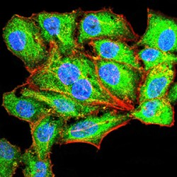 Alpha-1-Antitrypsin (SERPINA1) Antibody