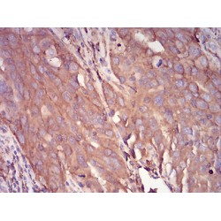 Alpha-1-Antitrypsin (SERPINA1) Antibody