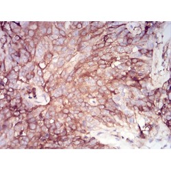 Alpha-1-Antitrypsin (SERPINA1) Antibody