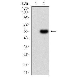 Alpha-1-Antitrypsin (SERPINA1) Antibody