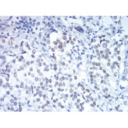 DEAD Box Polypeptide 5 (DDX5) Antibody