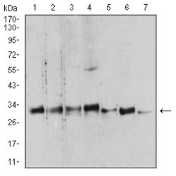 14-3-3 Protein Beta/Alpha (YWHAB) Antibody