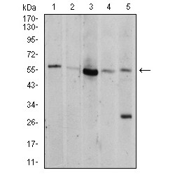 RAC-Alpha Serine/threonine-Protein Kinase (AKT1) Antibody
