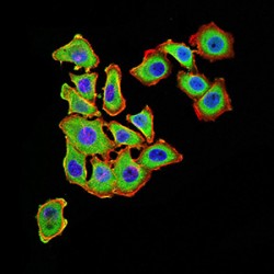 Mitochondrial Uncoupling Protein 3 (UCP3) Antibody