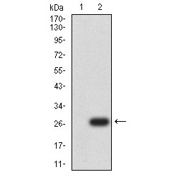 Mitochondrial Uncoupling Protein 3 (UCP3) Antibody