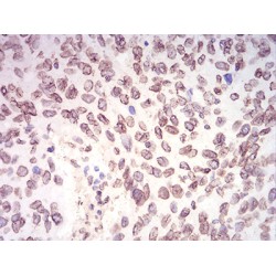 Lamin-B2 (LMNB2) Antibody