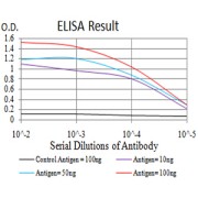 Fig. 1. Figure 1:Black line: Control Antigen (100 ng)Purple line: Antigen (10ng); Blue line: Antigen (50 ng); Red line:Antigen (100 ng)