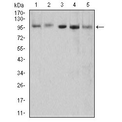 5'-3' Exoribonuclease 2 (XRN2) Antibody