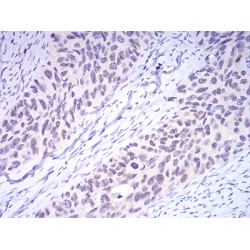 DNA (cytosine-5)-Methyltransferase 3A (DNMT3A) Antibody
