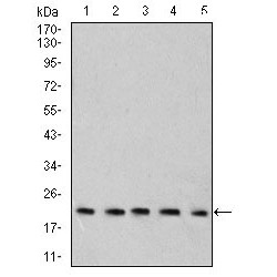 Ras-Related Protein Rab-6B (RAB6B) Antibody