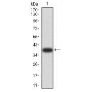 WB analysis of recombinant Human RAB6B (95-208 AA). Expected MW: 38.7 kDa.