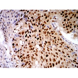Galectin 1 (LGALS1) Antibody