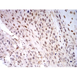 Galectin 1 (LGALS1) Antibody