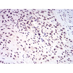 Lysine-Specific Histone Demethylase 1A (KDM1A) Antibody