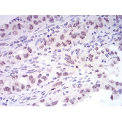 Lysine-Specific Histone Demethylase 1A (KDM1A) Antibody