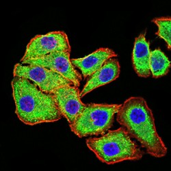 Phospholipase D2 (PLD2) Antibody