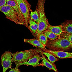 Phospholipase D2 (PLD2) Antibody