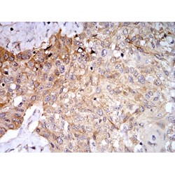 Phospholipase D2 (PLD2) Antibody