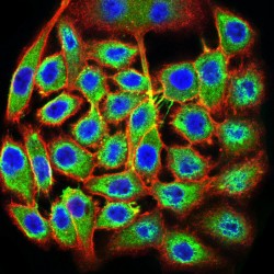 Transcription Termination Factor 1 (TTF1) Antibody