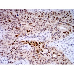 Transcription Termination Factor 1 (TTF1) Antibody