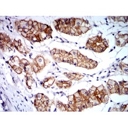 Catenin Alpha 1 (CTNNA1) Antibody