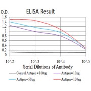 Fig. 1. Figure 1:Black line: Control Antigen (100 ng)Purple line: Antigen (10ng); Blue line: Antigen (50 ng); Red line:Antigen (100 ng)